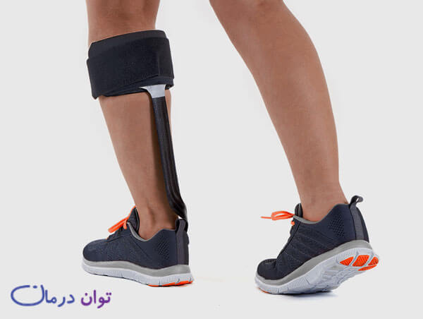 افراد نیازمند اعضا مصنوعی