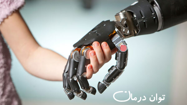 ارتز و پروتز