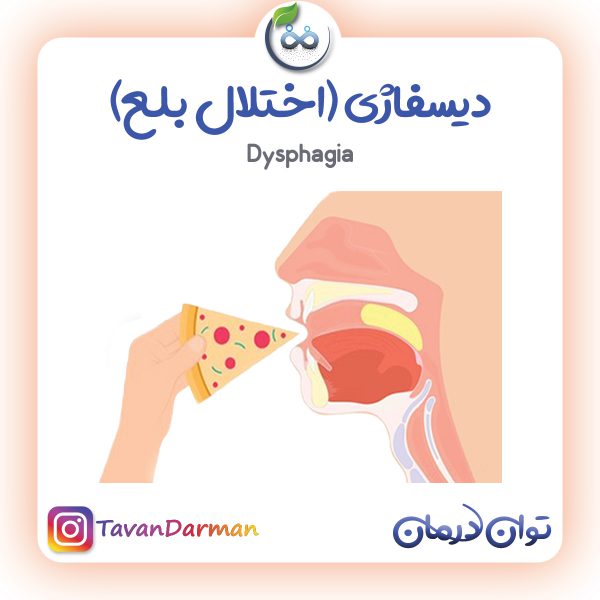دیسفاژی یا اختلال در بلع