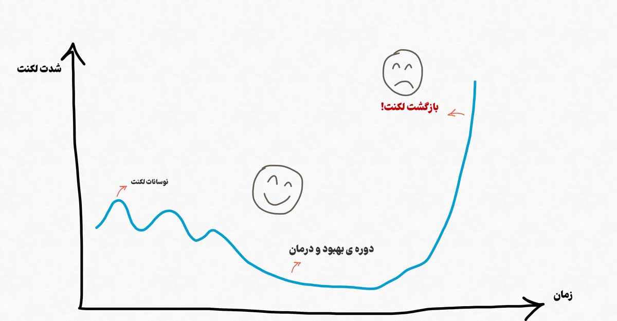 نوسانات و بازگشت لکنت